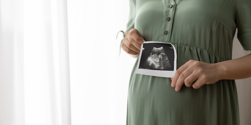 胎児のエコー写真を持つ妊婦さん