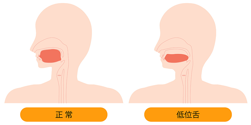 舌の位置