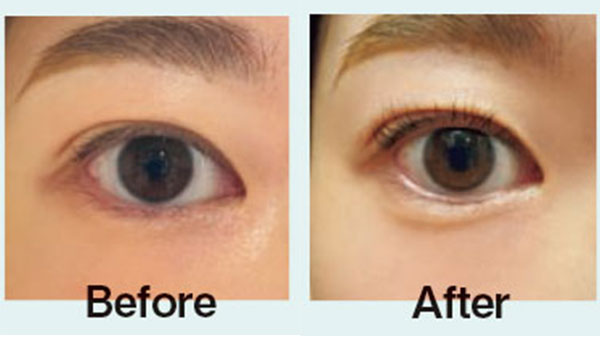 ビューラー before after