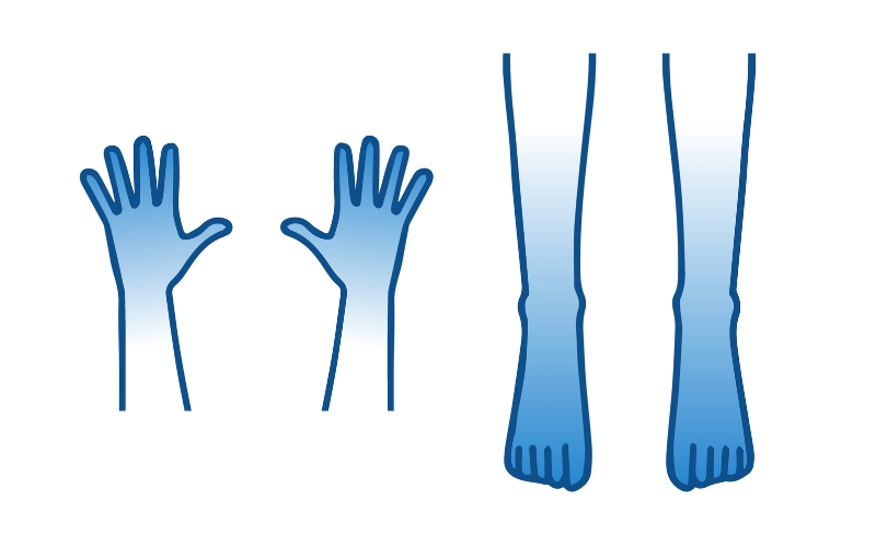 手足の冷え：イラスト