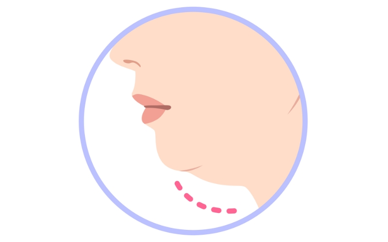 二重あごの女性