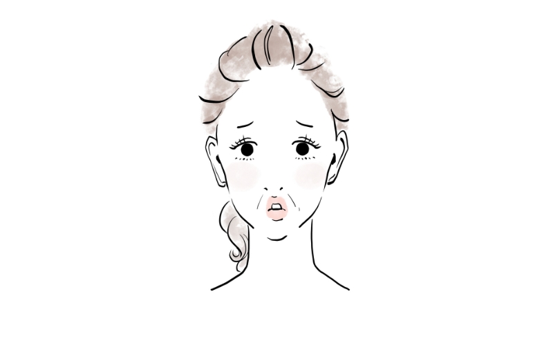 口元のたるみ 女性