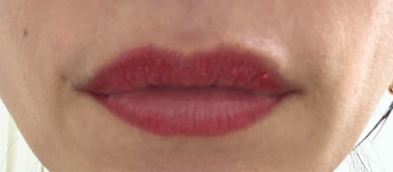アートメイク施術後の唇の写真。皮がむけている状態