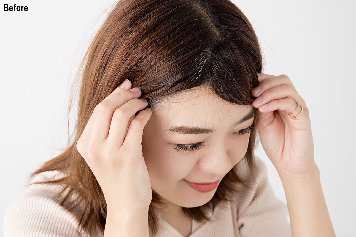 前髪を分けた白髪の部分が見えているビフォー写真