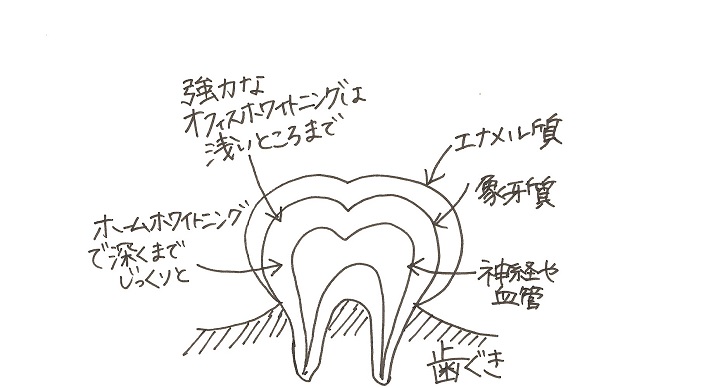説明図