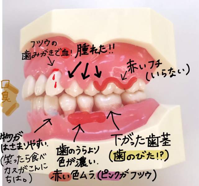 歯の症状